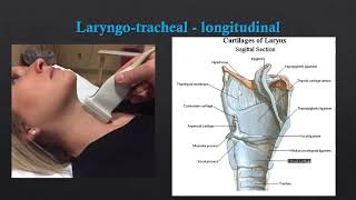 Neck US  Basic Anatomy [upl. by Sirc803]