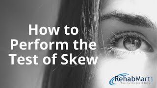 How to Perform the Test of Skew for Vertigo [upl. by Stilu169]