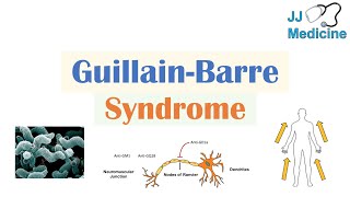 NCLEX Review on GuillainBarre Syndrome [upl. by Ainegue]