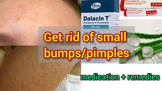 How to get rid of small bumps pimples after waxing and threading [upl. by Aneleiram]