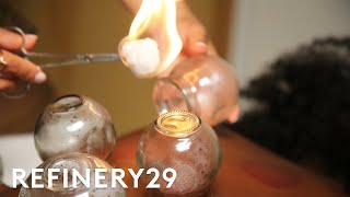 I Tried Cupping Therapy  Macro Beauty  Refinery29 [upl. by Aysan]