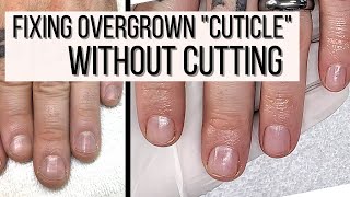 How to FIX Overgrown Cuticles WITHOUT CUTTING [upl. by Aura]