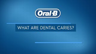 What are Dental Caries Treatments Signs and Symptoms  OralB [upl. by Pandolfi]