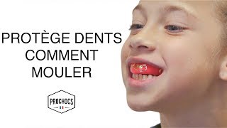 TUTO mouler son PROTÈGE DENTS pour ENFANTS  PROCHOCS [upl. by Hurless]