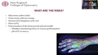 Coronary Artery Anatomy amp Imaging [upl. by Nesnej]