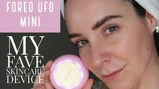 FOREO UFO Mini  Demo  ReviewOMG I love this device [upl. by Jamey126]