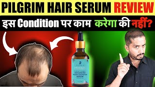 Pilgrim Advanced Hair Growth Serum Review  Genuine Tips [upl. by Essilec]