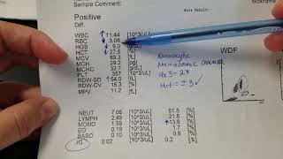 How to Interpret a CBC complete blood count Hematopathology amp Hematology with Dr Jeanette Ramos [upl. by Meli]