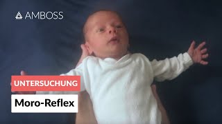 MoroReflex  Frühkindliche Reflexe  AMBOSS Video [upl. by Onitram820]