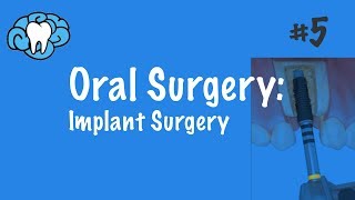 Oral Surgery  Implants  INBDE ADAT [upl. by Marka]