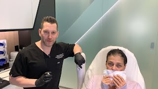 Female Facial Sculpting with Belotero  Smokers Lines and Lip Rejuvenation  West Hollywood CA [upl. by Farand559]