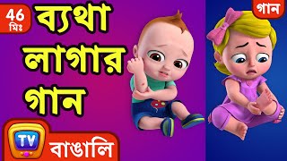 ব্যথা লাগার গান The Boo Boo Song  More Bangla Rhymes for Children  ChuChu TV [upl. by Alien]