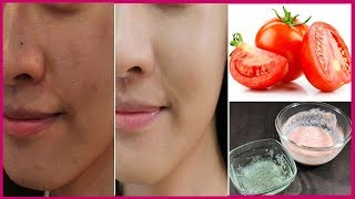 How To Remove Sun Tan in 1 Day  Magical Sun Tan Removal Remedy at Home [upl. by Tessil]