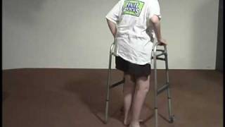 Abnormal Gait Exam  Neuropathic Gait [upl. by Walls293]