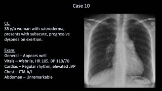 How to Interpret a Chest XRay Lesson 10  Self Assessment Part 2 [upl. by Regnij714]