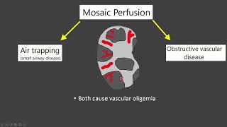 Mosaic Attenuation [upl. by Germayne]