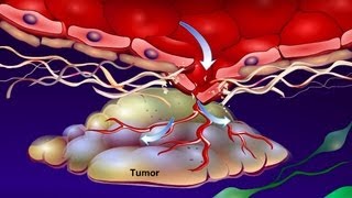 Advanced Cancer and End of Life Care [upl. by Clyte751]