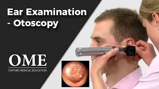 Otoscopy Ear Examination  ENT [upl. by Rep]