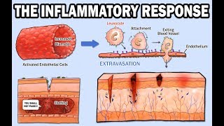 THE INFLAMMATORY RESPONSE [upl. by Nyre]