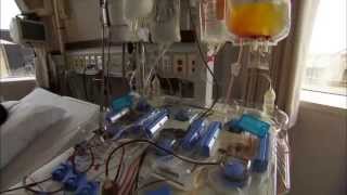 Bone Marrow Transplant Procedure and Recovery [upl. by Dibrin]