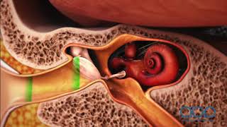 How the Ear Works  3D Medical Animation  ABP © [upl. by Nnylyak]