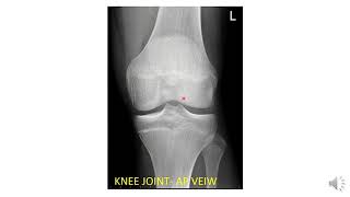 Radiological Anatomy of Lower Limb [upl. by Enirehtac]