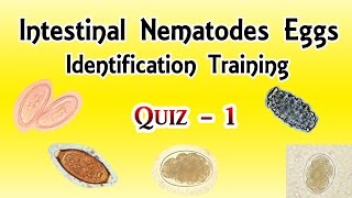 Intestinal Nematodes Eggs Identification Training Quiz 14 [upl. by Eek]