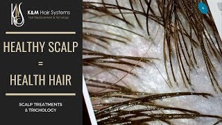 HEALTHY SCALP  HEALTHY HAIR  TRICHOLOGY [upl. by Veronica650]