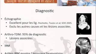 Ligamentoplastie cheville clinique du sport Dr CORDIER [upl. by Neeloj]