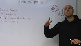 Glomerulopathy prequel to glomerulonephritis [upl. by Winthorpe529]