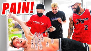 2HYPE EXTREME Cupping and Adjustment Therapy WORST PAIN EVER [upl. by Arbe673]