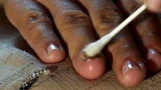 How to Cure Nail Fungus [upl. by Ghassan474]