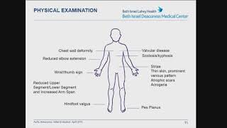 SonoWorld Pseudoaneurysms Diagnosis and Treatment [upl. by Abramo]