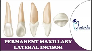 Permanent Maxillary Lateral Incisor  Tooth Morphology  Dental Anatomy [upl. by Magree881]