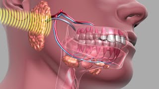 Principles of Cancer Treatment [upl. by Peppel]