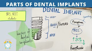 basics of dental implants  parts of implant [upl. by Nallac]