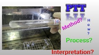 Prothrombin Time Test PT Hematology [upl. by Ayocal]