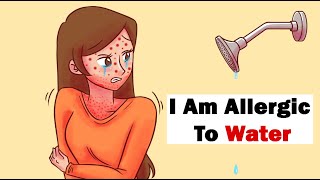 Allergies  Causes Symptoms and Treatment Options [upl. by Jayme832]