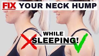 BEST sleeping position to FIX Neck Hump Hunchback or Forward Head Posture  Dr Jon Saunders [upl. by Zendah]