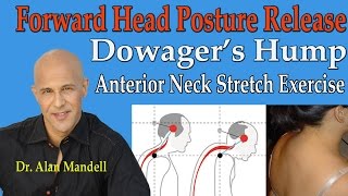 Forward Head Posture Release Dowagers Hump Anterior Neck Stretches  Dr Mandell [upl. by Pilar]