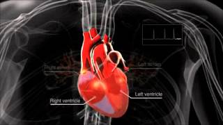 AF and how AF causes stroke [upl. by Marlie238]