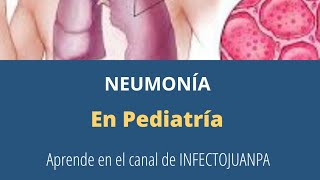 Neumonía en Pediatría [upl. by Zacherie]