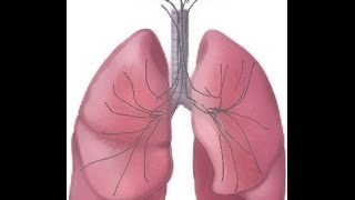 BREATH SOUNDS Stages of Fluid Overload Pneumonia [upl. by Prunella]