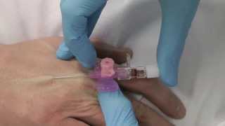 Cannulation How to gain IV access [upl. by Lemart]