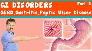 GI Disorders GERD Gastritis peptic ulcer Disease Part 5 [upl. by Vihs940]