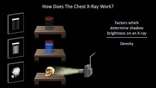 How to Interpret a Chest XRay Lesson 1  An Introduction [upl. by Grosz]