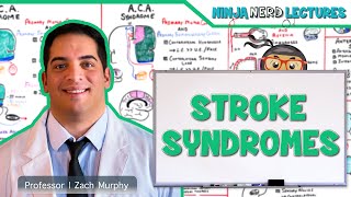 Stroke Syndromes MCA ACA ICA PCA Vertebrobasilar Artery Strokes  Pathophysiology [upl. by Naxela12]