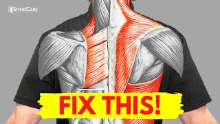 How to Fix Muscle Pain Between Your Shoulder Blades for Good [upl. by Hyrup526]