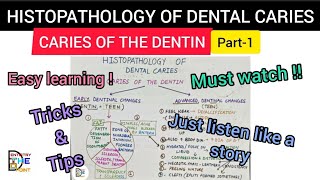 HISTOPATHOLOGY OF DENTAL CARIES  CARIES OF THE DENTIN PART1 [upl. by Cissie711]