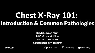 RadCast Academy Introduction To The Chest XRay amp Common Pathologies cxr radcast [upl. by Devina]